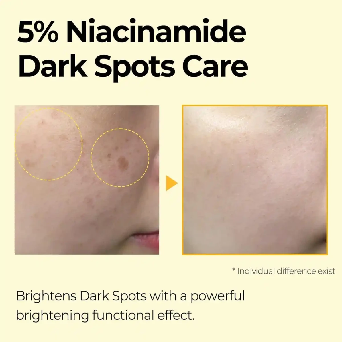 SOME BY MI Yuja Niacin Dark Spot Correcting Stick Mini - 5g - Image 3