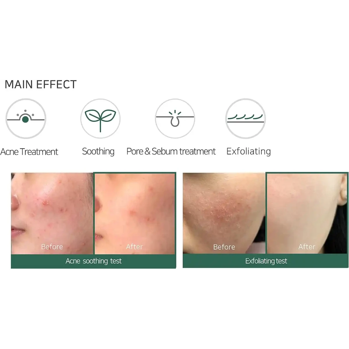 SOME BY MI AHA-BHA-PHA 30 Days Miracle Acne Clear Foam - 100ml - Image 5