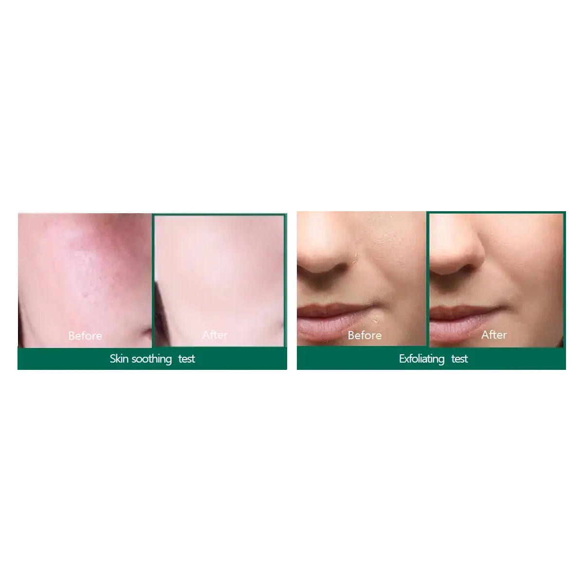 SOME BY MI AHA BHA PHA 30 Days Miracle Serum-50ml - Image 2