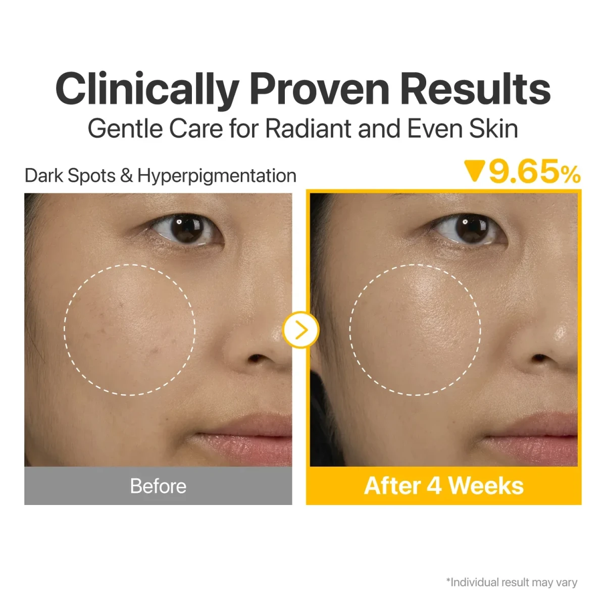 NUMBUZIN No.5 Vitamin Concentrated Serum