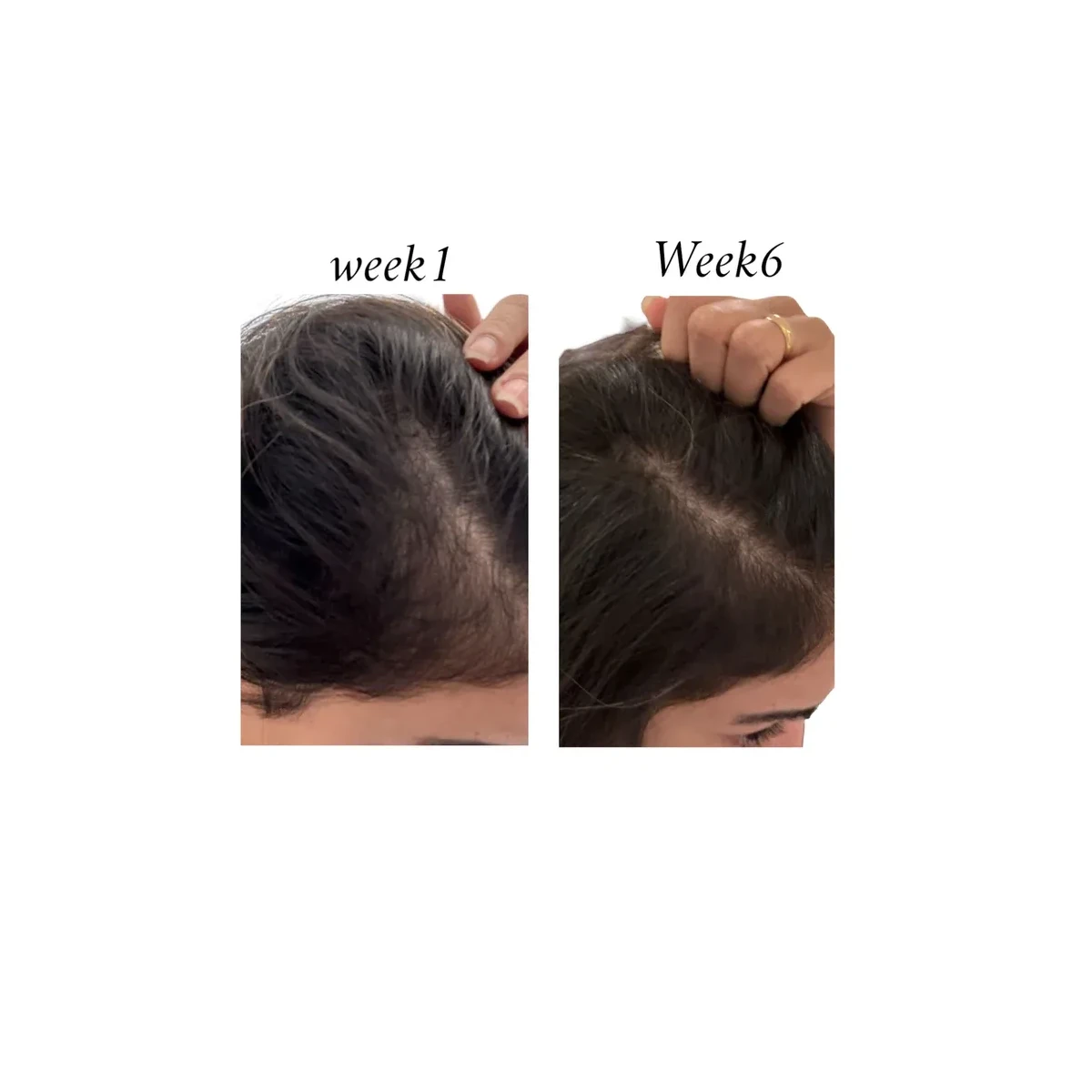 Raw African Follicle Booster Redensyl Daily Spray