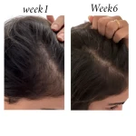 Raw African Follicle Booster Redensyl Daily Spray