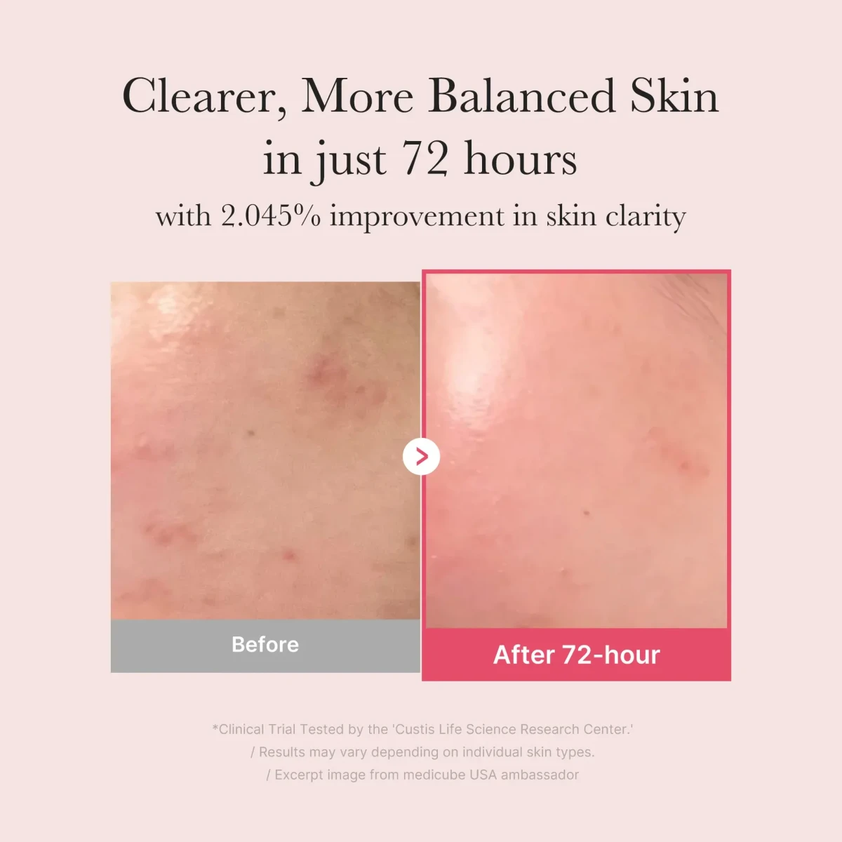 MEDICUBE TXA Niacinamide 15% Serum