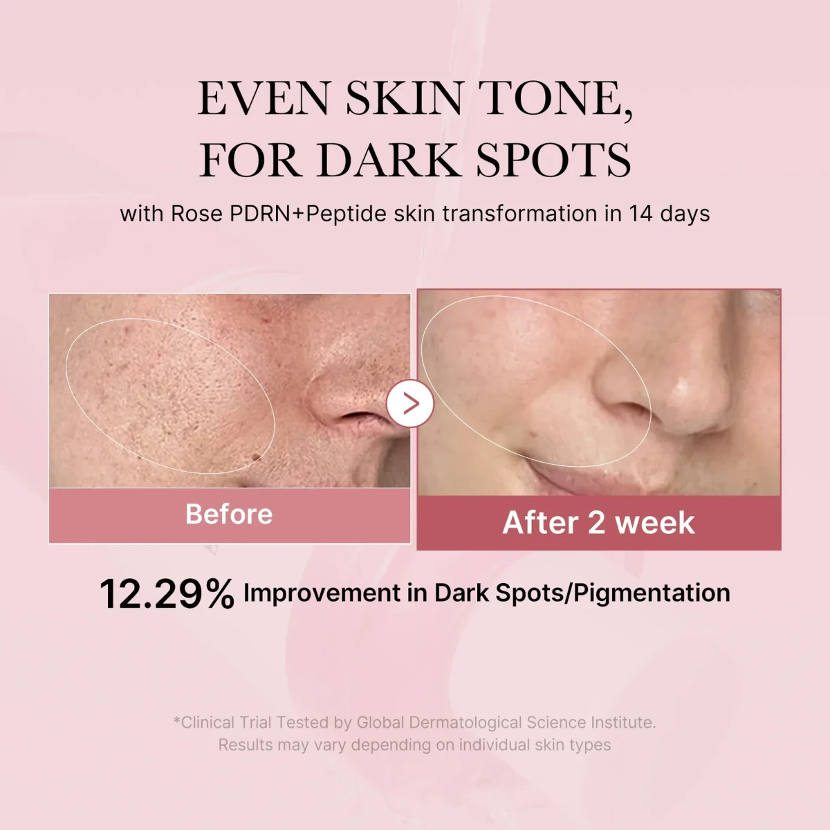 MEDICUBE pdrn Pink cica soothing toner